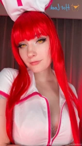 16149731