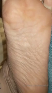 15876385