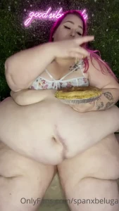 15566624