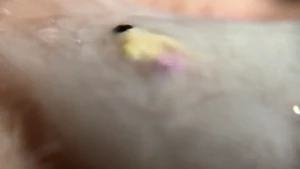12576564