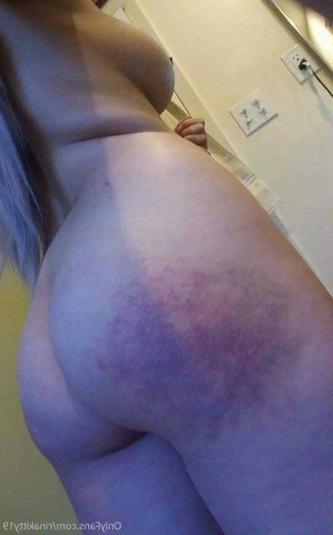 RinKitty🪲FREE FULL LENGTH VIDS! [ rinakitty19 ] Onlyfans leaked photo 1028029 on Hotleaks.tv