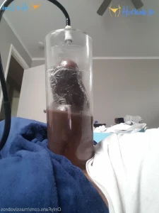 11909031