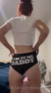 15541324