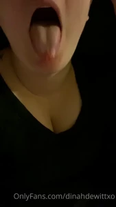 15542265