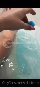 18063665