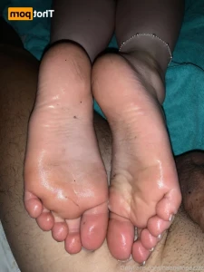 16170478