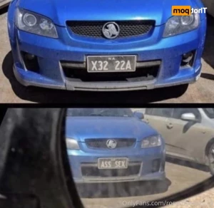 11340933