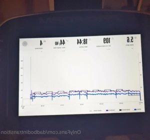 16009911