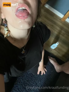 15532488