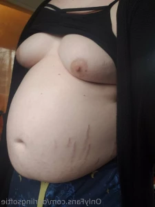 11570156