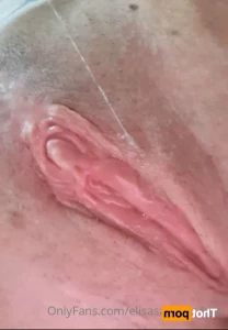 16099499