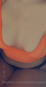 15577849