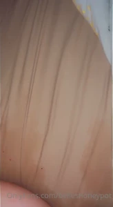 15577866