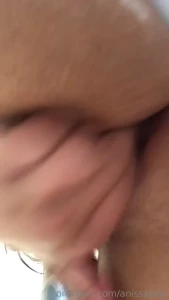 15182891