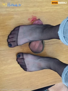 15758335