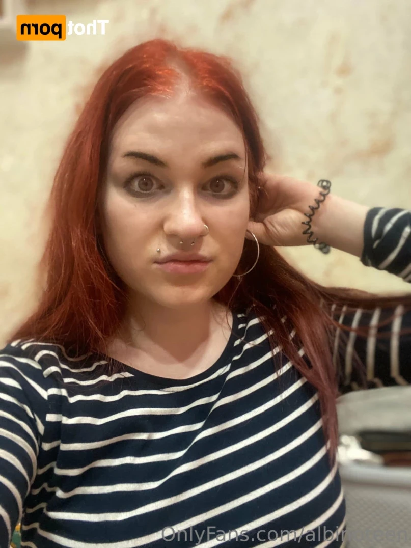 albinoteen Onlyfans leaked photo 14382009 on Hotleaks.tv