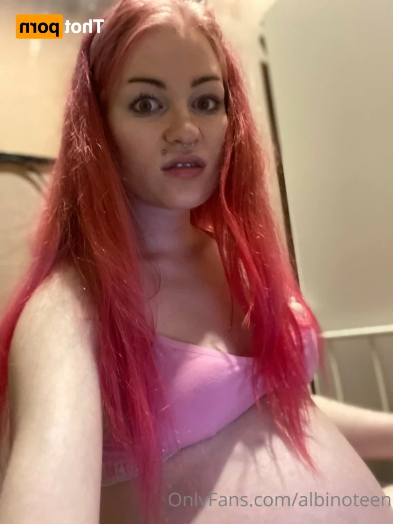 albinoteen Onlyfans leaked photo 16387136 on Hotleaks.tv