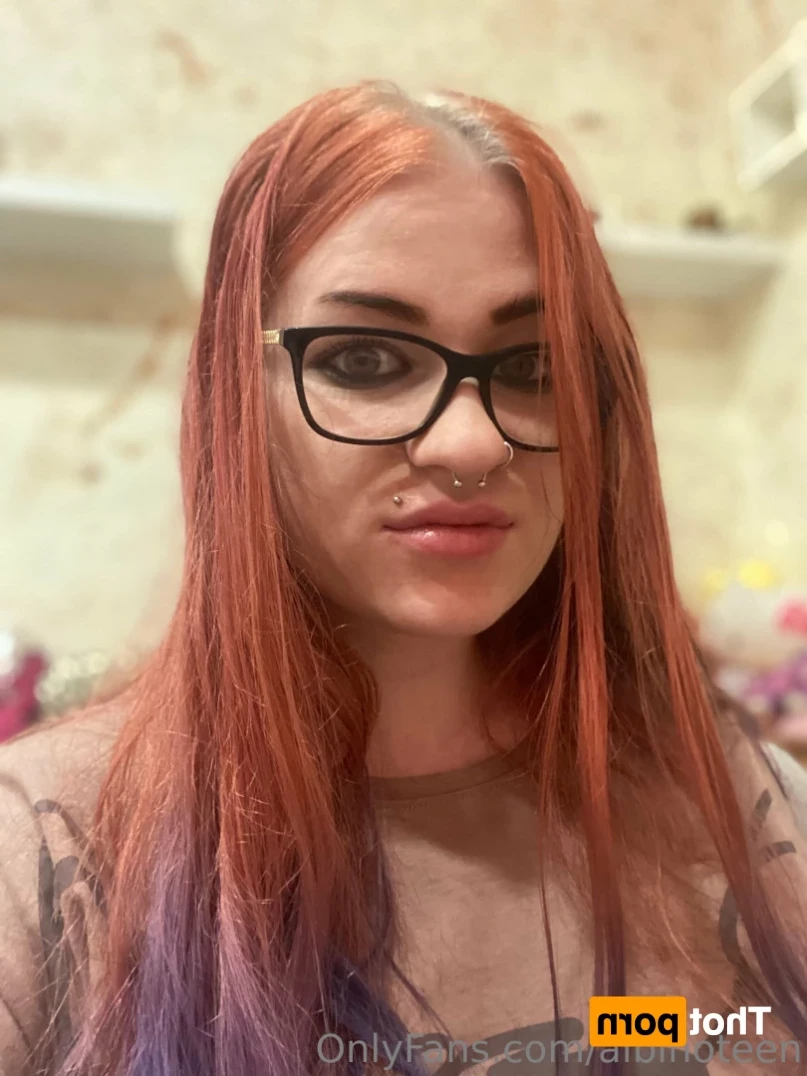 albinoteen Onlyfans leaked photo 16387139 on Hotleaks.tv