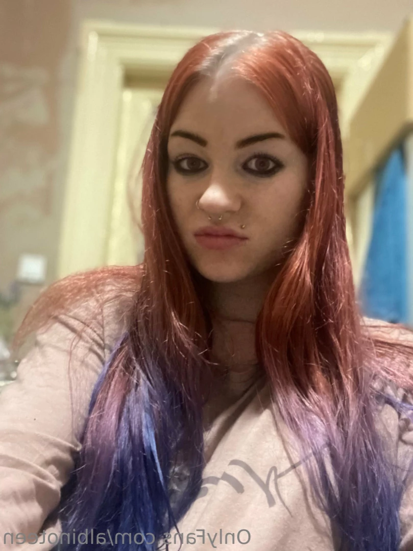 albinoteen Onlyfans leaked photo 16387140 on Hotleaks.tv