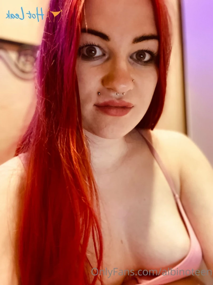 albinoteen Onlyfans leaked photo 16387142 on Hotleaks.tv