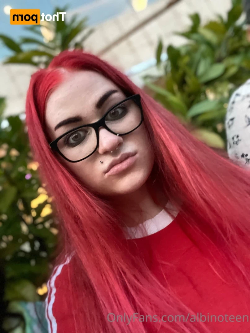 albinoteen Onlyfans leaked photo 16387143 on Hotleaks.tv