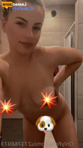 15569860