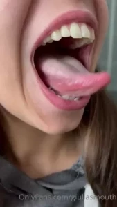 18061923