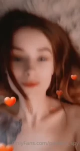 18056649