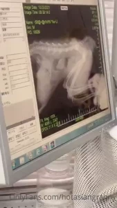 Hot Asian Granny [ hotasiangranny ] Onlyfans leaked video 18052676 on Hotleaks.tv