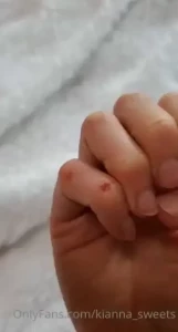 18037501
