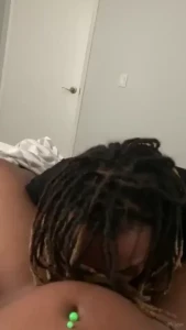 18034265
