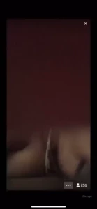 18034284