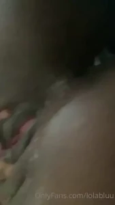 18026624