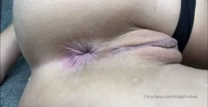 18026581