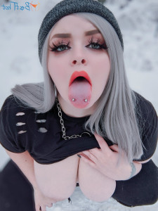 17866809
