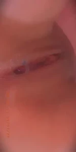 18002204