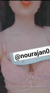 17992665