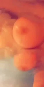 17986634