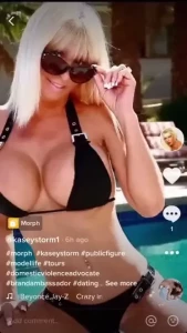 17978556