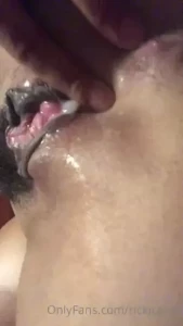 17976718