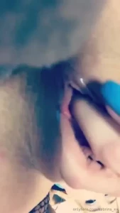 17972296