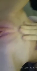 17970395