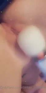 17935443