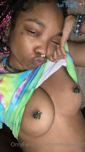 17377999