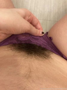 18136622