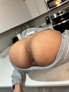 18419815
