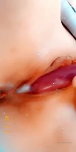 18358544
