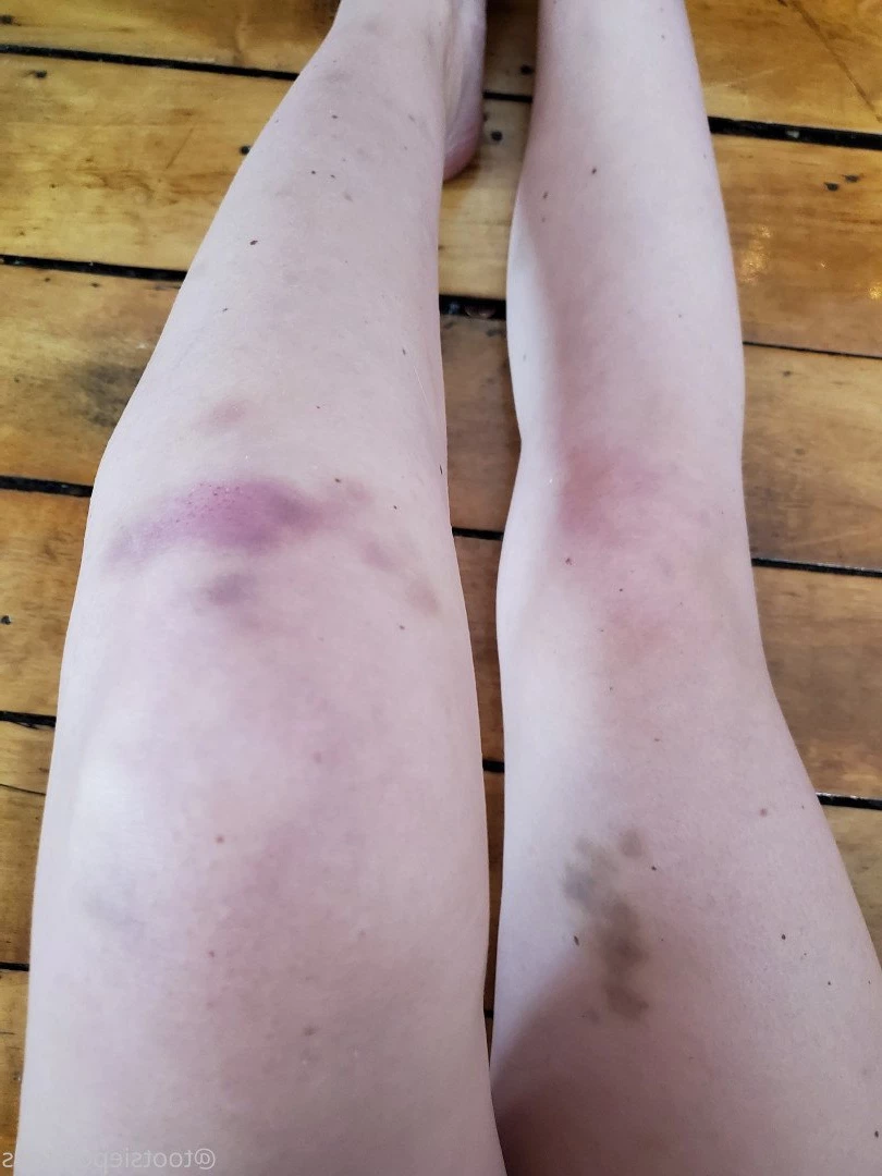  [ tootsiepoptoes ] Onlyfans leaked photo 4652005 on Hotleaks.tv