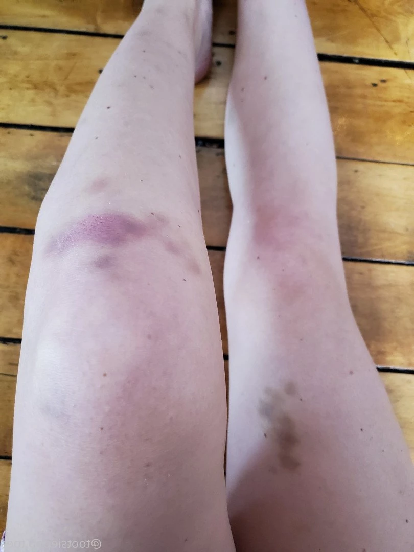  [ tootsiepoptoes ] Onlyfans leaked photo 4652877 on Hotleaks.tv