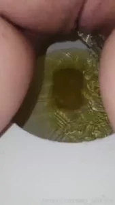 18547017